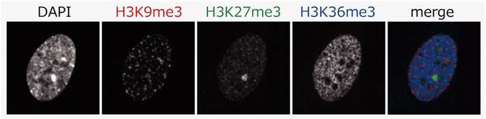 Dynamics of chromatin and epigenetic regulation in vivo