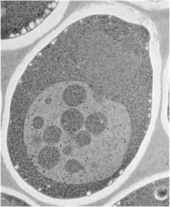 Molecular mechanism and physiological understanding of autophagy